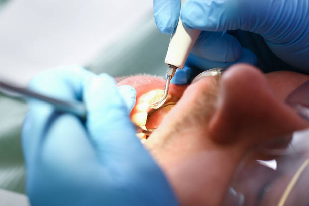 Best Emergency Treatment for Toothache in Grandy, NC